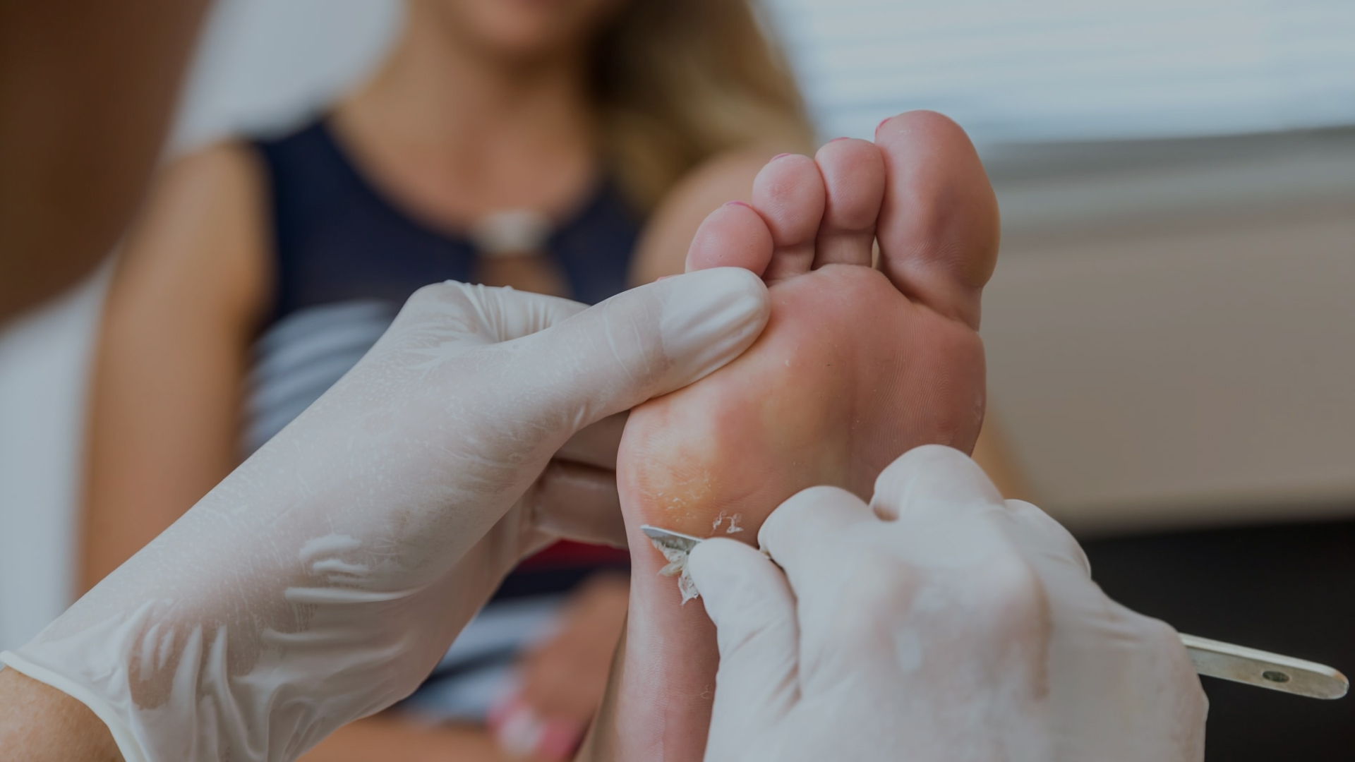 Foot Pain Reduction in Women with the Best Medical Pedicure Treatment in UAE for Foot Calluses and Corns 